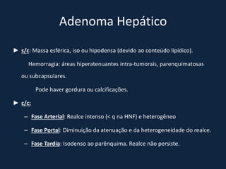 Adenoma Hepático
► s/c: Massa esférica, iso ou hipodensa (devido ao conteúdo lipídico).

      Hemorragia: áreas hiperatenuantes intra-tumorais, parenquimatosas
   ou subcapsulares.

         Pode haver gordura ou calcificações.

► c/c:

    – Fase Arterial: Realce intenso (< q na HNF) e heterogêneo

    – Fase Portal: Diminuição da atenuação e da heterogeneidade do realce.

    – Fase Tardia: Isodenso ao parênquima. Realce não persiste.
 