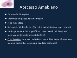 Abscesso Amebiano
► Entamoeba histolytica
► Endêmico em países de clima tropical
► ♂ de meia idade
► Secundário à infecção do cólon (sítio extra-intestinal mais comum)
► Lesão geralmente única, periférica, >3 cm, sendo o lobo direito
  mais frequentemente acometido (72%)
► Complicações: Abscesso subfrênico ou subhepático, fístulas com
  pleura e pericárdio, rotura para cavidade peritoneal
 