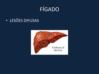 FÍGADO
• LESÕES DIFUSAS
 