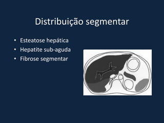 Distribuição segmentar
• Esteatose hepática
• Hepatite sub-aguda
• Fibrose segmentar
 