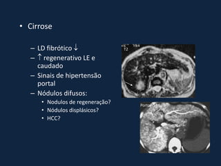 • Cirrose

   – LD fibrótico                T2

   –  regenerativo LE e
     caudado
   – Sinais de hipertensão
     portal
   – Nódulos difusos:
      • Nodulos de regeneração?        Portografia
      • Nódulos displásicos?
      • HCC?
 