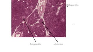 Lóbulo pancreático
2
Ilhota pancreática Ácinos serosos
 