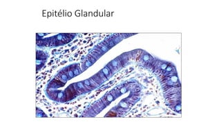Epitélio Glandular
 