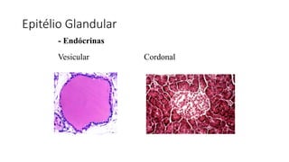 Epitélio Glandular
- Endócrinas
Vesicular Cordonal
 