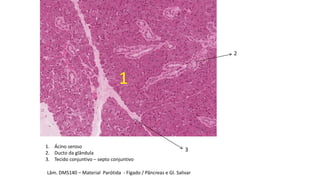 1. Ácino seroso
2. Ducto da glândula
3. Tecido conjuntivo – septo conjuntivo
1
2
3
Lâm. DMS140 – Material Parótida - Fígado / Pâncreas e Gl. Salivar
 