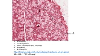 1. Ácino seroso
2. Ducto da glândula
3. Tecido conjuntivo – septo conjuntivo
4. Ácino misto
5. Ácino mucoso
1
3
2
4
5
http://histology.med.umich.edu/medical/oral-cavity-and-salivary-glands
Lâm 183 – 1 / Gl. Sublingual
 
