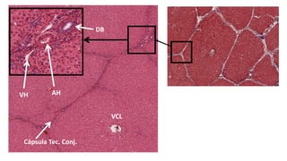 VCL
DB
AHVH
Cápsula Tec. Conj.
 