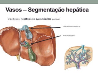 2 pedículos: Hepático (inf) e Supra-hepático (post-sup)
Pedículo Hepático
Pedículo Supra-Hepático
 