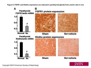 Copyright ©2010 American Society of Nephrology Figure 9. FGFR1 and Klotho expression are reduced in parathyroid glands from uremic rats in vivo 