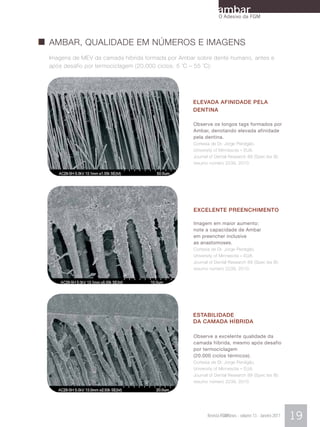 ambarFGM
                                                              O Adesivo da




AMBAR, QUALIDADE EM NÚMEROS E IMAGENS
Imagens de MEV da camada híbrida formada por Ambar sobre dente humano, antes e
após desafio por termociclagem (20.000 ciclos, 5 ºC – 55 ºC):




                                                 ELEVADA AFINIDADE PELA
                                                 DENTINA

                                                  Observe os longos tags formados por
                                                  Ambar, denotando elevada afinidade
                                                  pela dentina.
                                                  Cortesia de Dr. Jorge Perdigão,
                                                  University of Minnesota – EUA.
                                                  Journal of Dental Research 89 (Spec Iss B):
                                                  resumo número 2239, 2010.




                                                  EXCELENTE PREENCHIMENTO

                                                  Imagem em maior aumento:
                                                  note a capacidade de Ambar
                                                  em preencher inclusive
                                                  as anastomoses.
                                                  Cortesia de Dr. Jorge Perdigão,
                                                  University of Minnesota – EUA.
                                                  Journal of Dental Research 89 (Spec Iss B):
                                                  resumo número 2239, 2010.




                                                 ESTABILIDADE
                                                 DA CAMADA HÍBRIDA

                                                  Observe a excelente qualidade da
                                                  camada híbrida, mesmo após desafio
                                                  por termociclagem
                                                  (20.000 ciclos térmicos).
                                                  Cortesia de Dr. Jorge Perdigão,
                                                  University of Minnesota – EUA.
                                                  Journal of Dental Research 89 (Spec Iss B):
                                                  resumo número 2239, 2010.




                                                         Revista FGMNews - volume 13 - Janeiro 2011   19
 