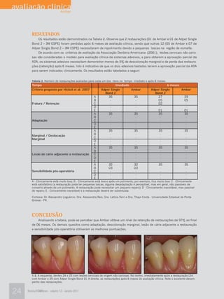 avaliação clínica
              Ambar




        RESULTADOS
            Os resultados estão demonstrados na Tabela 2. Observe que 2 restaurações (01 de Ambar e 01 de Adper Single
        Bond 2 – 3M ESPE) foram perdidas após 6 meses de avaliação clínica, sendo que outras 12 (05 de Ambar e 07 de
        Adper Single Bond 2 – 3M ESPE) necessitaram de repolimento devido a pequenas lascas na região de esmalte.
            De acordo com os critérios de avaliação da Associação Dentária Americana (2001), lesões cervicais não cario-
        sas são consideradas o modelo para avaliação clínica de sistemas adesivos, e para obterem a aprovação parcial da
        ADA, os sistemas adesivos necessitam demonstrar menos de 5% de descoloração marginal e de perda das restaura-
        ções (retenção) após 6 meses. Isto é indicativo de que os dois adesivos testados teriam a aprovação parcial da ADA
        para serem indicados clinicamente. Os resultados estão tabelados a seguir:


        Tabela 2. Número de restaurações avaliadas para cada um dos itens no tempo imediato e após 6 meses.
        Tempo                                                           Imediado                                 6 meses
        Critério proposto por Hickel et al. 2007               Adper Single      Ambar                 Adper Single      Ambar
                                                                 Bond 2                                  Bond 2
                                                         A         35             35                       27             29
                                                         B          -              -                       05             05
        Fratura / Retenção                               C          -              -                       02              -
                                                         D          -              -                        -              -
                                                         E          -              -                       01             01
                                                         A         35             35                       35             35
                                                         B          -              -                        -              -
        Adaptação                                        C          -              -                        -              -
                                                         D          -              -                        -              -
                                                         E          -              -                        -              -
                                                         A         35             35                       35             35
                                                         B          -              -                        -              -
        Marginal / Deslocação
                                                         C          -              -                        -              -
        Marginal
                                                         D          -              -                        -              -
                                                         E          -              -                        -              -
                                                         A         35             35                       35             35
                                                         B          -              -                        -              -
        Lesão de cárie adjacente a restauração           C          -              -                        -              -
                                                         D          -              -                        -              -
                                                         E          -              -                        -              -
                                                         A         32             32                       35             35
                                                         B         03             03                        -              -
        Sensibilidade pós-operatória                     C          -              -                        -              -
                                                         D          -              -                        -              -
                                                         E          -              -                        -              -
        A - Clinicamente está muito boa; B - Clinicamente está boa e após um polimento, por exemplo, fica muito boa; C - Clinicamente
        está satisfatório (a restauração pode ter pequenas lascas, alguma desadaptação é perceptível, mas em geral, não passíveis de
        conserto através de um polimento. A restauração pode necessitar um pequeno reparo); D - Clinicamente inaceitável, mas passível
        de reparo; E - Clinicamente inaceitável e a restauração deverá ser substituída.

        Cortesia: Dr. Alessandro Loguércio, Dra. Alessandra Reis, Dra. Letícia Ferri e Dra. Thays Costa - Universidade Estadual de Ponta
        Grossa - PR.




        CONCLUSÃO
            Analisando a tabela, pode-se perceber que Ambar obteve um nível de retenção de restaurações de 97% ao final
        de 06 meses. Os demais quesitos como adaptação, descoloração marginal, lesão de cárie adjacente a restauração
        e sensibilidade pós-operatória obtiveram as melhores pontuações.




        1-3. A esquerda, dentes 24 e 25 com lesões cervicais de origem não cariosas. No centro, imediatamente após a restauração (24
        com Ambar e 25 com Adper Single Bond 2). A direita, as restaurações após 6 meses de avaliação clínica. Note o excelente desem-
        penho das restaurações.



24   Revista FGMNews - volume 13 - Janeiro 2011
 
