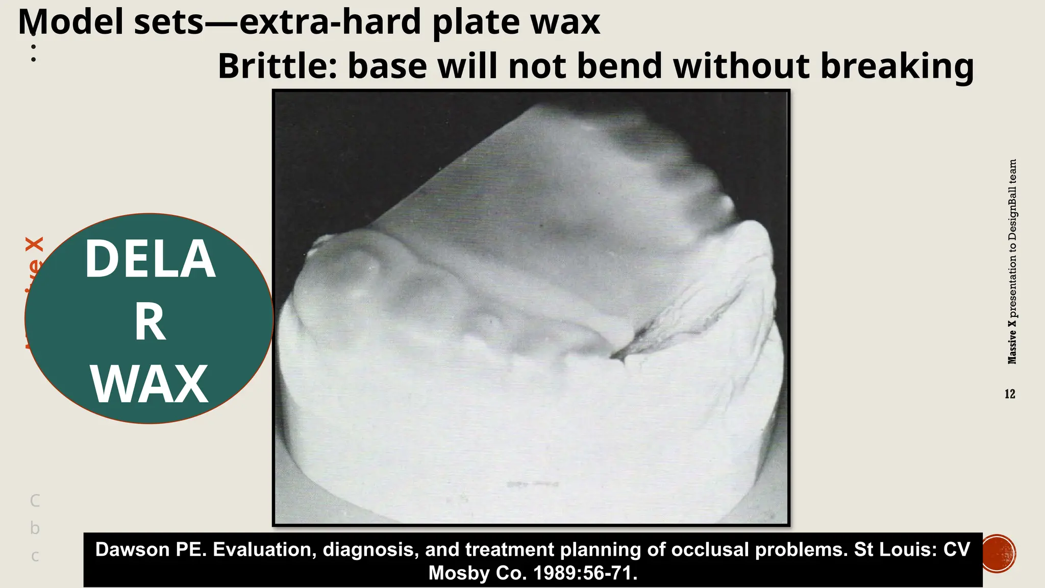 Massive
X
presentation
to
DesignBall
team
Massive
X
12
b
C
c
Model sets—extra-hard plate wax
Dawson PE. Evaluation, diagnosis, and treatment planning of occlusal problems. St Louis: CV
Mosby Co. 1989:56-71.
Brittle: base will not bend without breaking
DELA
R
WAX
 