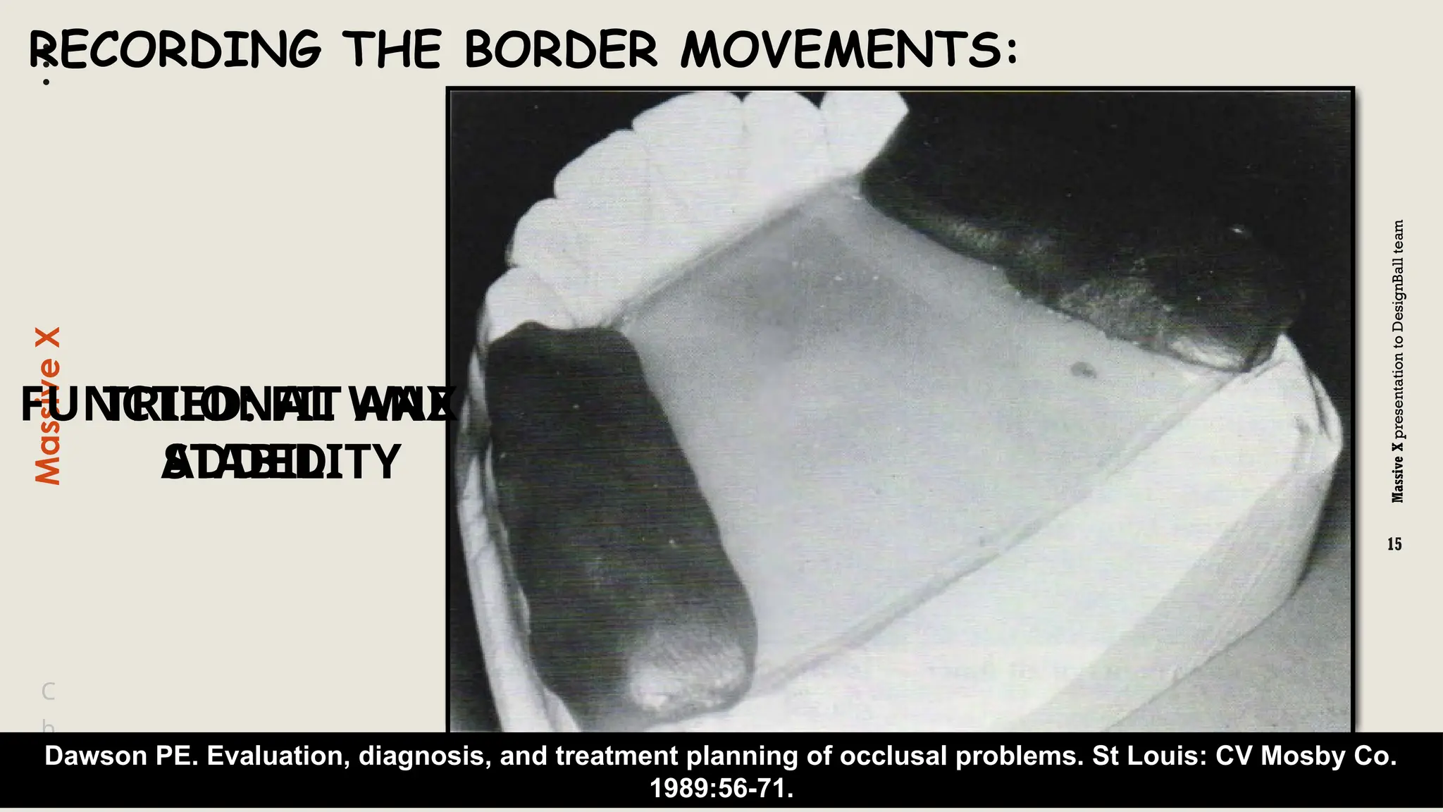 Massive
X
presentation
to
DesignBall
team
Massive
X
15
b
C
c
Dawson PE. Evaluation, diagnosis, and treatment planning of occlusal problems. St Louis: CV Mosby Co.
1989:56-71.
RECORDING THE BORDER MOVEMENTS:
TRIED: FIT AND
STABILITY
FUNCTIONAL WAX
ADDED
 