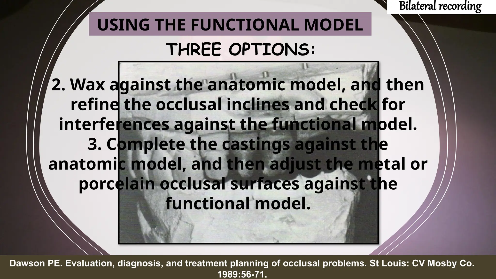 THREE OPTIONS:
25
Dawson PE. Evaluation, diagnosis, and treatment planning of occlusal problems. St Louis: CV Mosby Co.
1989:56-71.
2. Wax against the anatomic model, and then
refine the occlusal inclines and check for
interferences against the functional model.
3. Complete the castings against the
anatomic model, and then adjust the metal or
porcelain occlusal surfaces against the
functional model.
USING THE FUNCTIONAL MODEL
Bilateral recording
 