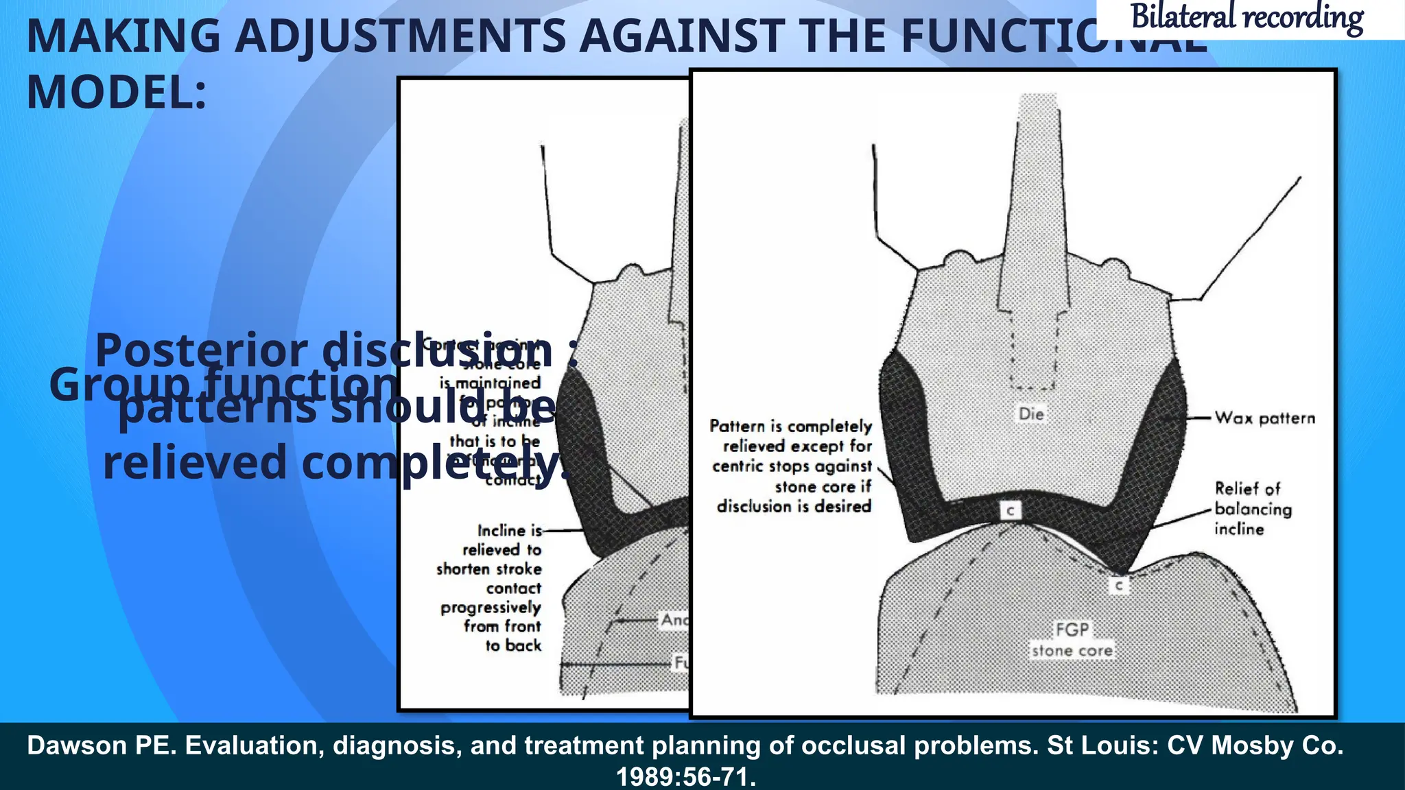 MAKING ADJUSTMENTS AGAINST THE FUNCTIONAL
MODEL:
Group function
Dawson PE. Evaluation, diagnosis, and treatment planning of occlusal problems. St Louis: CV Mosby Co.
1989:56-71.
Posterior disclusion :
patterns should be
relieved completely.
Bilateral recording
 