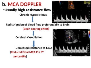 FGR-TYPES AND DOPPLER CHANGES FINAL PPT.pptx