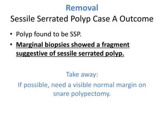 Removal
Sessile Serrated Polyp Case A Outcome
• Polyp found to be SSP.
• Marginal biopsies showed a fragment
suggestive of sessile serrated polyp.
Take away:
If possible, need a visible normal margin on
snare polypectomy.
 