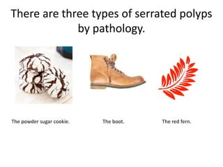 There are three types of serrated polyps
by pathology.
The boot. The red fern.The powder sugar cookie.
 