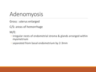 Adenomyosis
Gross : uterus enlarged
C/S: areas of hemorrhage
M/E:
◦ irregular nests of endometrial stroma & glands arranged within
myometrium
◦ separated from basal endometrium by 2-3mm
 
