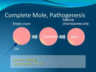 Complete Mole, Pathogenesis
Duplication 46XX
Empty ovum
23X
Diandric diploidy
Androgenesis M:F 2:0
Paternal
chromosomes only
 