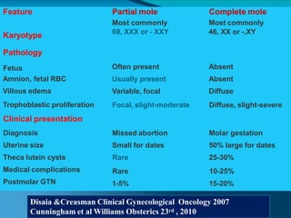 Feature
Karyotype
Partial mole
Most commonly
69, XXX or - XXY
Complete mole
Most commonly
46, XX or -,XY
Often present
Usually present
Variable, focal
Focal, slight-moderate
Absent
Absent
Diffuse
Diffuse, slight-severe
Pathology
Fetus
Amnion, fetal RBC
Villous edema
Trophoblastic proliferation
Clinical presentation
Diagnosis
Uterine size
Theca lutein cysts
Medical complications
Postmolar GTN
Missed abortion
Small for dates
Rare
Rare
1-5%
Molar gestation
50% large for dates
25-30%
10-25%
15-20%
Disaia &Creasman Clinical Gynecological Oncology 2007
Cunningham et al Williams Obsterics 23rd , 2010
 
