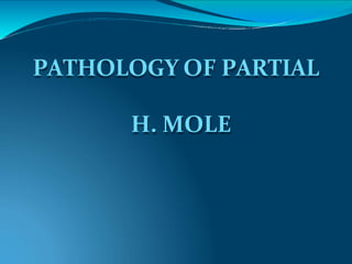PATHOLOGY OF PARTIAL
H. MOLE
 