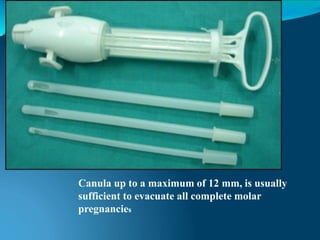 Canula up to a maximum of 12 mm, is usually
sufficient to evacuate all complete molar
pregnancies
 
