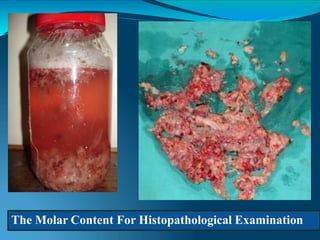 The Molar Content For Histopathological Examination
 