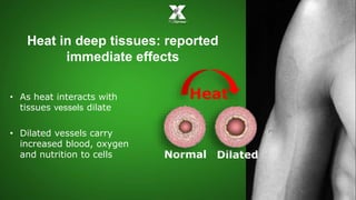 Heat in deep tissues: reported 
immediate effects 
Normal Dilated 
• As heat interacts with 
tissues vessels dilate 
• Dilated vessels carry 
increased blood, oxygen 
and nutrition to cells 
Heat 
 