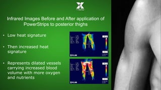 Infrared Images Before and After application of 
PowerStrips to posterior thighs 
• Low heat signature 
• Then increased heat 
signature 
• Represents dilated vessels 
carrying increased blood 
volume with more oxygen 
and nutrients 
 