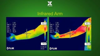 Infrared Arm 
 