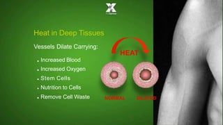 Heat in Deep Tissues
Vessels Dilate Carrying:
•
•
•
•
•
Increased Blood
Increased Oxygen
Stem Cells
Nutrition to Cells
Remove Cell Waste
HEAT
NORMAL DILATED
 