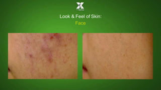 Face
Look & Feel of Skin:
 