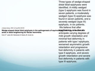 Three types of wedge-shaped
distal tibial epiphyses were
identified. A mildly wedged
(type I) epiphysis was found in
seven patients, a moderately
wedged (type II) epiphysis was
found in seven patients, and a
severely wedged (type III)
epiphysis, in six patients.
We believe that after
lengthening, one should
anticipate varying degrees of
mild growth retardation and
minimal foot deformity in
patients with type I epiphysis,
worsened asymmetric growth
retardation and progressive
foot deformity in patients with
type II epiphysis, and severe
growth retardation and severe
foot deformity in patients with
type III epiphysis.
 