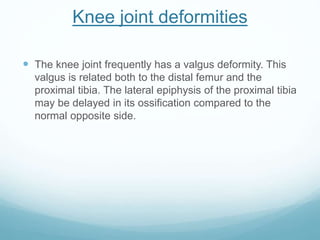Knee joint deformities
 The knee joint frequently has a valgus deformity. This
valgus is related both to the distal femur and the
proximal tibia. The lateral epiphysis of the proximal tibia
may be delayed in its ossification compared to the
normal opposite side.
 