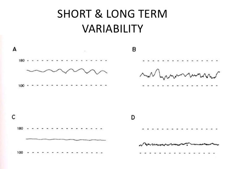 Fht interpretation & management