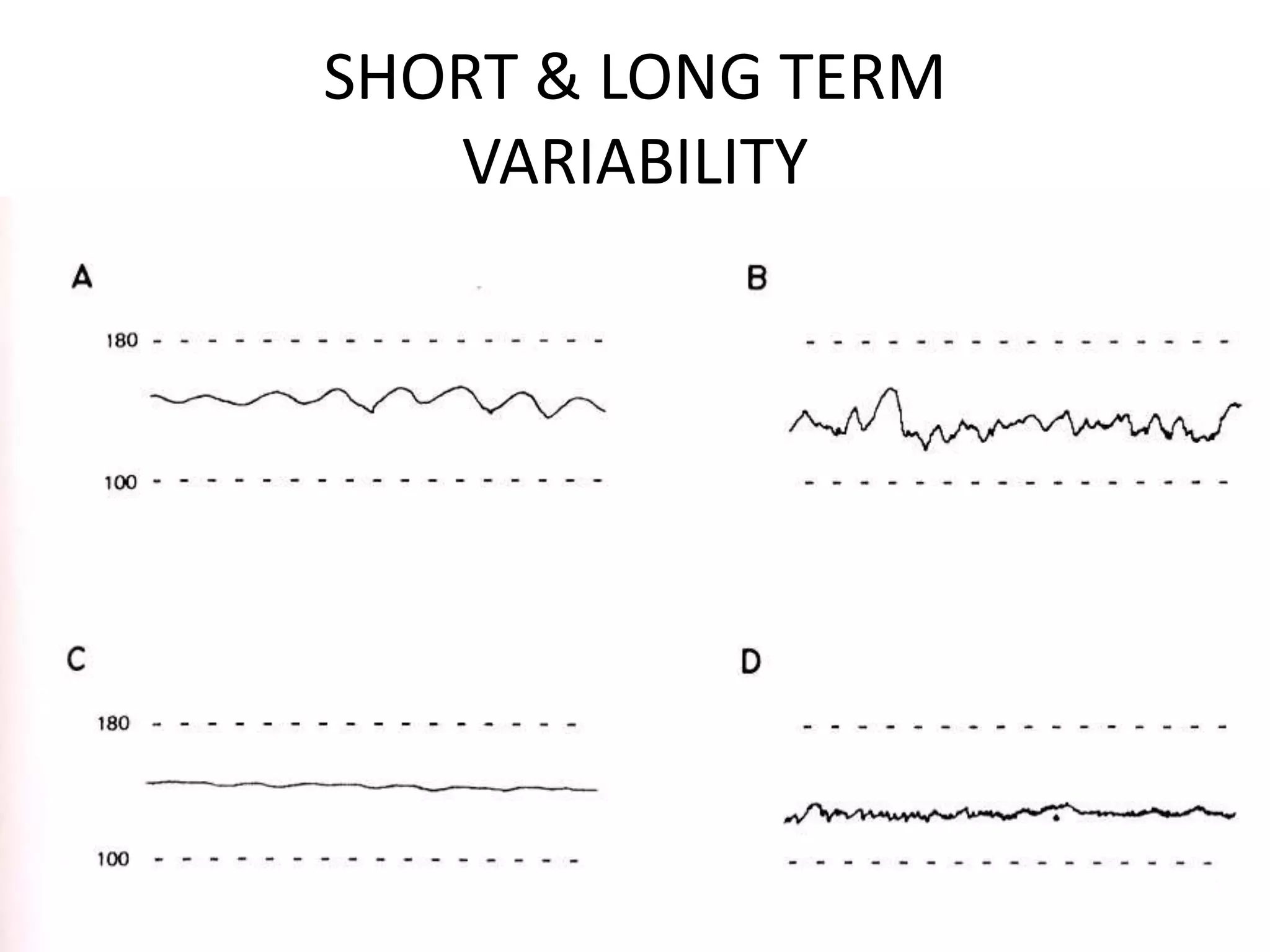 SHORT & LONG TERM
   VARIABILITY
 
