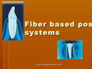 Fiber based pos
systems

www.indiandentalacademy.com

 