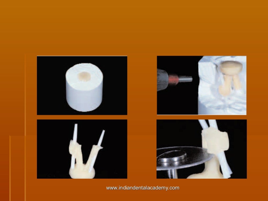 Fiber based post systems/ cosmetic dentistry training