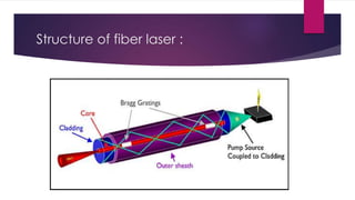 Structure of fiber laser :
 