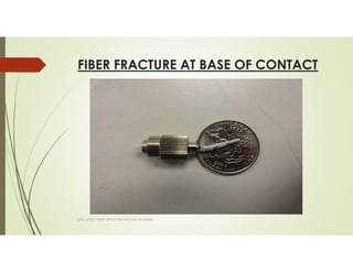 FIBER FRACTURE AT BASE OF CONTACT
SAPL BASIC FIBER OPTICS TECHNICIAN TRAINING
 