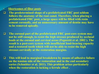 Fiber post | PPTX