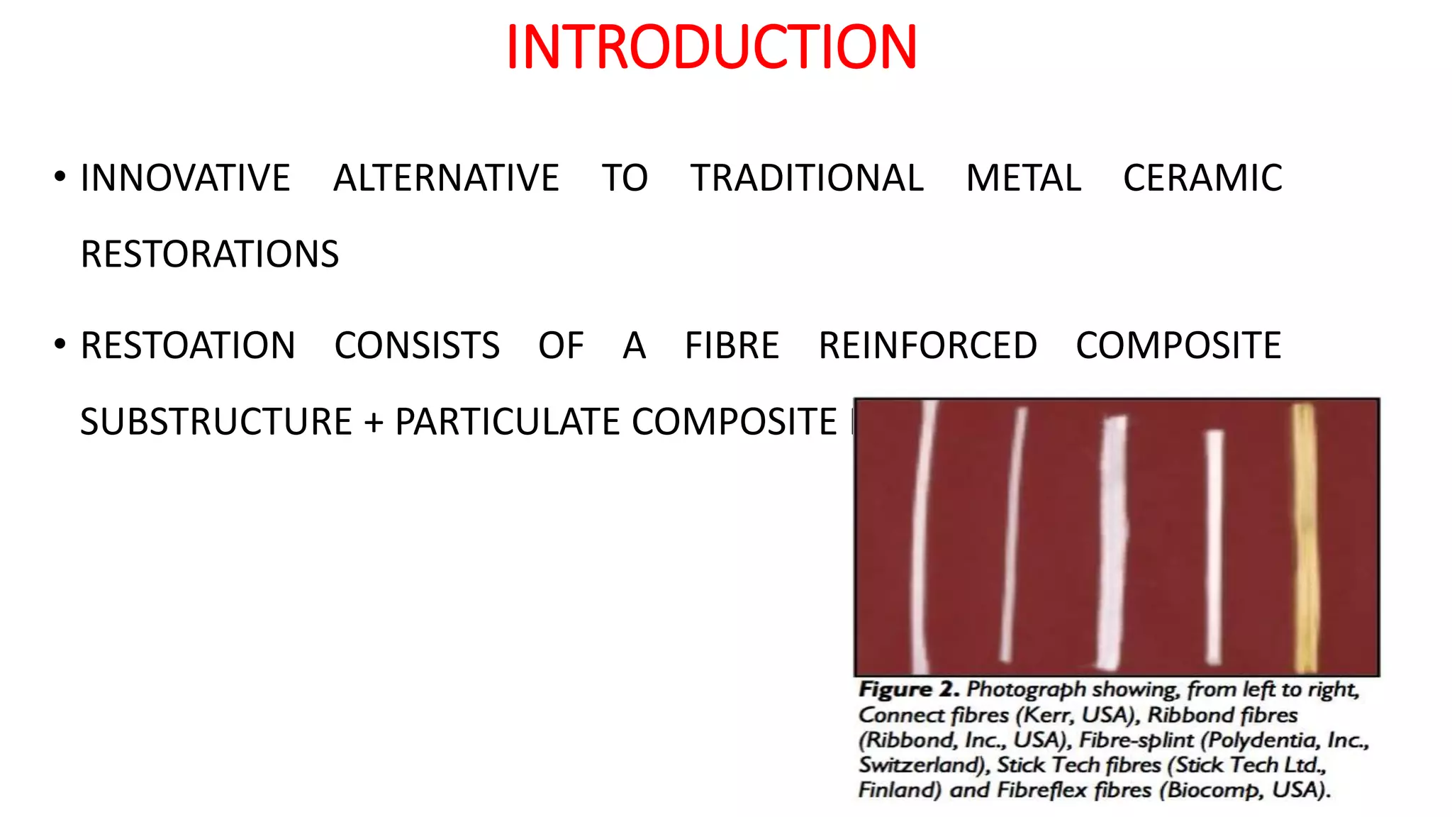 Fiber reinforced composite fixed prosthesis | PPTX