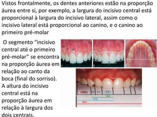 Vistos frontalmente, os dentes anteriores estão na proporção
áurea entre si, por exemplo, a largura do incisivo central está
proporcional à largura do incisivo lateral, assim como o
incisivo lateral está proporcional ao canino, e o canino ao
primeiro pré-molar
O segmento “incisivo
central até o primeiro
pré-molar” se encontra
na proporção áurea em
relação ao canto da
boca (final do sorriso).
A altura do incisivo
central está na
proporção áurea em
relação à largura dos
dois centrais.
 