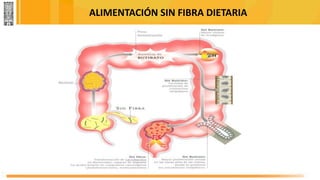 ALIMENTACIÓN SIN FIBRA DIETARIA
 