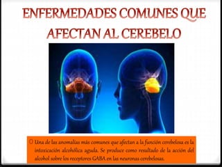 0 Una de las anomalías más comunes que afectan a la función cerebelosa es la
intoxicación alcohólica aguda. Se produce como resultado de la acción del
alcohol sobre los receptores GABA en las neuronas cerebelosas.
 
