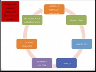 AGENESIA O
HIPOPLASIA
CONGENITA
TRAUMATISMO
INFECCIONES
TUMORES
ESCLEROSIS
MULTIPLE
ALTERACIONES
VACULARES
INTOXICACION POR
METALES PESADOS
Los siguientes
procesos
afectan con
frecuencia al
cerebelo:
 
