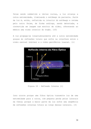 feixe sendo submetido a várias curvas, a luz alcança a
outra extremidade, iluminando o estômago do paciente. Parte
da luz é, então, refletida no interior do estômago e retoma
pelo outro feixe, de forma análoga, sendo detectada, e
convertida em imagem num monitor de vídeo, oferecendo ao
médico uma visão interior do órgão. [10]


A luz propaga-se longitudinalmente até a outra extremidade
graças às reflexões totais que sofre na interface entre o
vidro central (núcleo) e o vidro periférico (casca). [1]




             Figura 18 – Reflexão Interna [1]




Isso ocorre porque uma fibra óptica transmite luz de uma
extremidade para a outra, com pequena perda pelas laterais
da fibra; porque a maior parte da luz sofre uma seqüência
de reflexões internas totais ao longo dessas laterais. [3]




                                                           30
 