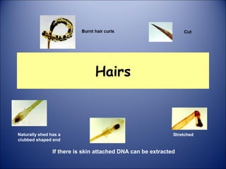 Hairs
Naturally shed has a
clubbed shaped end
Stretched
If there is skin attached DNA can be extracted
 