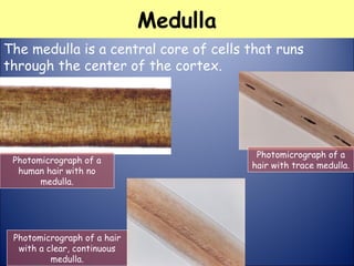 Medulla
Photomicrograph of a
human hair with no
medulla.
Photomicrograph of a
hair with trace medulla.
Photomicrograph of a hair
with a clear, continuous
medulla.
The medulla is a central core of cells that runs
through the center of the cortex.
 